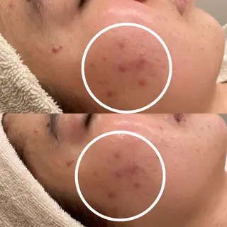 田中For..天王寺 肌質改善/よもぎ蒸しのエステ・リラクイメージ