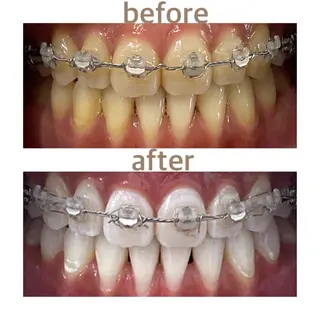 メンズ ホワイトニング ショップ本八幡店のエステ・リラクイメージ