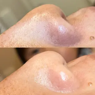 meili beautyのエステ・リラクイメージ