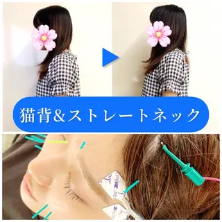 小顔美容鍼専門サロン 渋谷YZのエステ・リラクイメージ