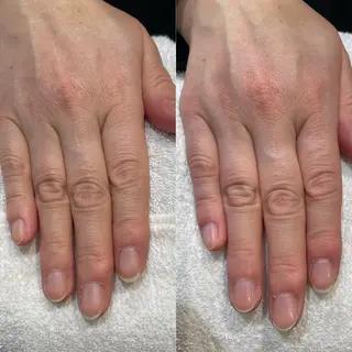 ネイル 痛くないシミ取り 【荻窪】石橋のヘアスタイル