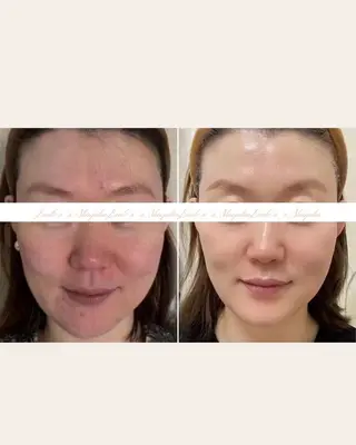 痩身/腸もみ/ ヘッドスパ/リンパのエステ・リラクイメージ