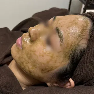 肌質改善Charme coco  みさのエステ・リラクイメージ