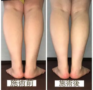 小顔・毛穴・たるみ ネイル　似内真樹のエステ・リラクイメージ