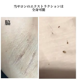 private salon Dea_maris シュガーリング&パーソナルボディケア所属・シミ改善・韓国肌管理 ボディメイク痩身のその他イメージ