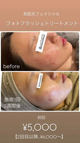 yellow.所属・yellow💛【 脱毛&フェイシャル】のエステ・リラクイメージ