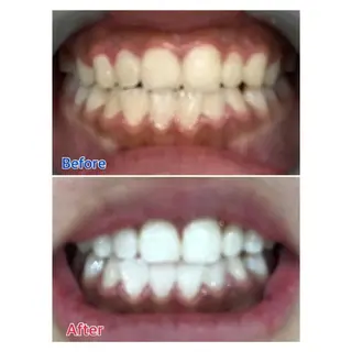 MBEAUTYSALON 千葉店・京成大久保所属・Melty 輝のその他イメージ