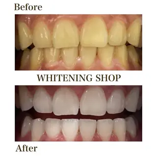ホワイトニングショップ伊丹店所属・ホワイトニング ショップ伊丹店のその他イメージ