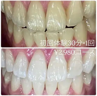 メンズ ホワイトニングルーム　川崎店所属・ホワイトニング ルーム　川崎店のその他イメージ