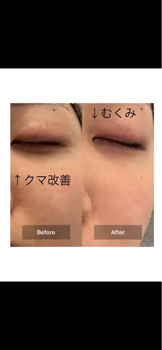 目元・まつパ・美肌フ ェイシャル谷町四丁目のマツエク・マツパデザイン