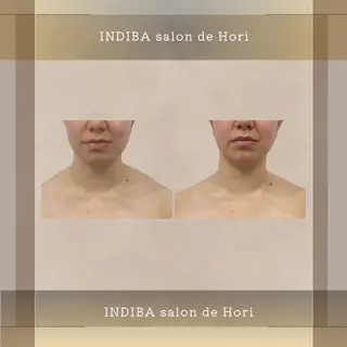 メンズ INDIBA Salon小澤るいのエステ・リラクイメージ