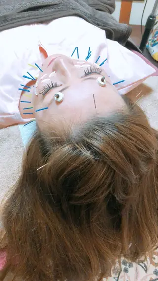 美容鍼灸女性専用 りんご鍼灸治療院のその他イメージ