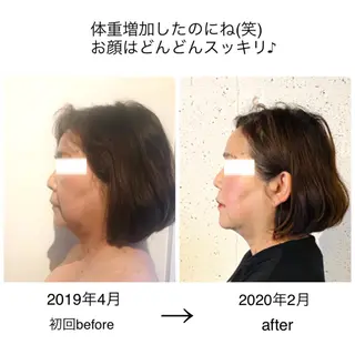 ミディアム パーマ ネイル 小顔矯正専門サロンジュマリ所属・町田 淳子のエステ・リラクイメージ
