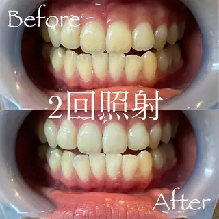 LBSホワイトニング 新宿店💝公式のその他イメージ