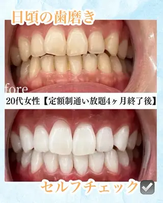 メンズ キッズ ホワイトニング専門店 WHITE天神店のエステ・リラクイメージ