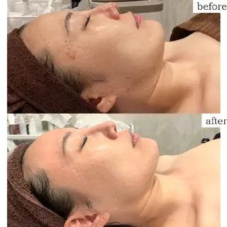 DahliaBeauty ダリアビューティー所属・春日井市Dahlia Beauty　中村のエステ・リラクイメージ