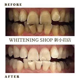 メンズ ホワイトニング ショップ新小岩店のその他イメージ