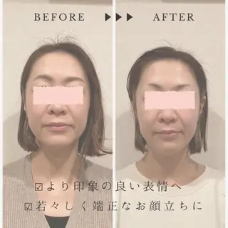 小顔×肌質改善サロン soin〔ソワン〕のエステ・リラクイメージ