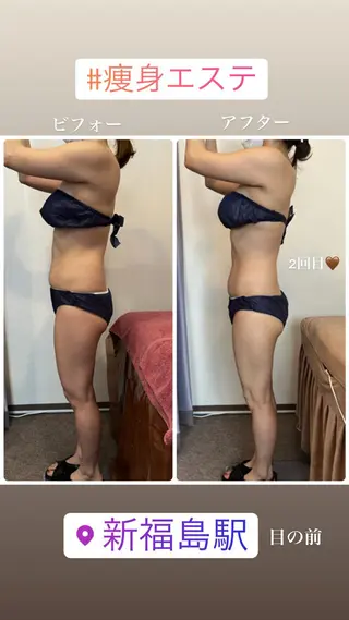 FLEUR大阪・整体 ・ハイフ・痩身・小顔のエステ・リラクイメージ