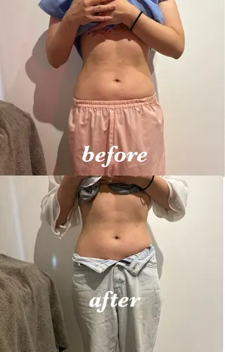 腸活サポート みなみののエステ・リラクイメージ