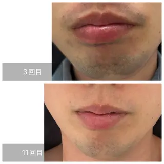 メンズ エマニエル USAのその他イメージ