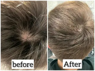 ショート メンズ VOGUE所属・VOGUE 増毛エクステのヘアスタイル