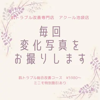 撲滅🔥 最短ニキビ改善のエステ・リラクイメージ