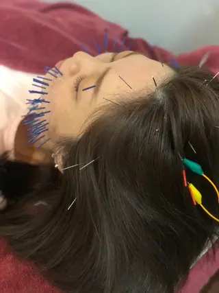 美容鍼灸女性専用 りんご鍼灸治療院のその他イメージ