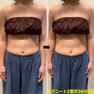 脱毛＆エステサロン【アンリミット】所属・森谷 莉美のエステ・リラクイメージ