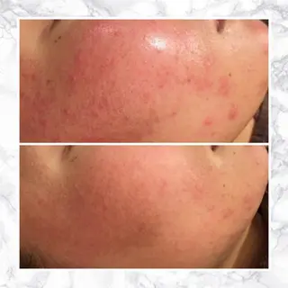 セミロング カラー パーマ ヘアアレンジ メンズ キッズ ネイル マツエク・マツパ アイブロウ 触れたくなる モテ肌へ...❤︎のエステ・リラクイメージ