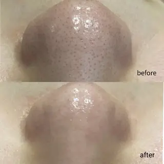 DahliaBeauty ダリアビューティー所属・DahliaBeau tyフェイシャル中村のその他イメージ