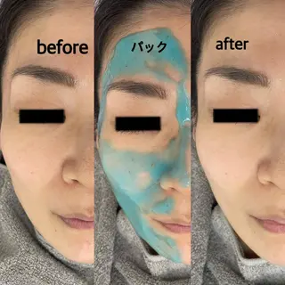 肌ケア&毛穴洗浄 Cheriのエステ・リラクイメージ