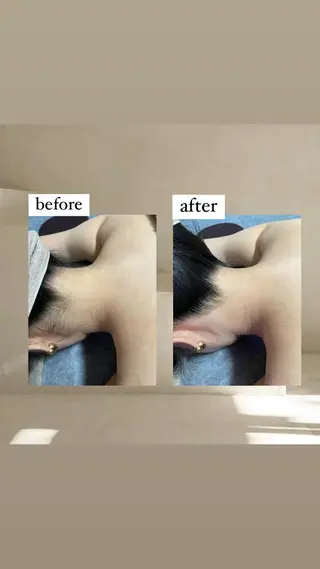 crescent所属・【韓国肌管理・脱毛】 クレセントのエステ・リラクイメージ