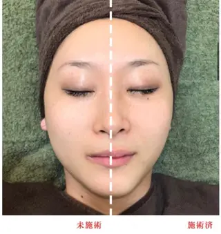 BestBelleꕤ 大阪福島/肌質改善のエステ・リラクイメージ