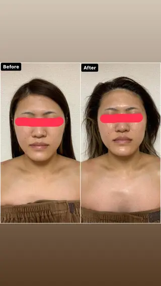 透明感の肌Lino malieのエステ・リラクイメージ