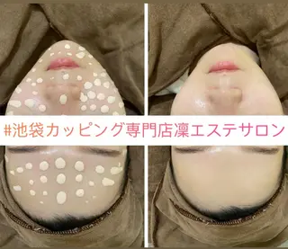 カッピング＆カッサ専門店凜所属・川嶋 凜のエステ・リラクイメージ