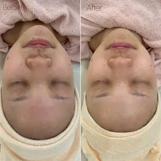 〈etre〉トータルビューティーサロン所属・etre - 韓国肌管理 -のエステ・リラクイメージ