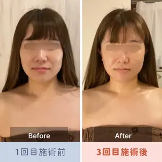 眉毛×小顔矯正サロン パピヨンsakiのエステ・リラクイメージ