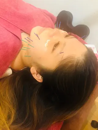 美容鍼灸女性専用 りんご鍼灸治療院のその他イメージ