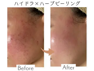 プライベートサロン Belle(ベル)のエステ・リラクイメージ