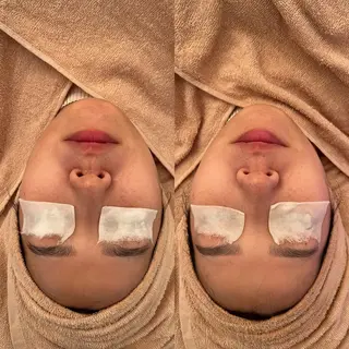 毛穴ケア/毛穴診断/ 毛穴洗浄〔心斎橋〕のエステ・リラクイメージ