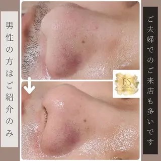 Glossy salonのエステ・リラクイメージ