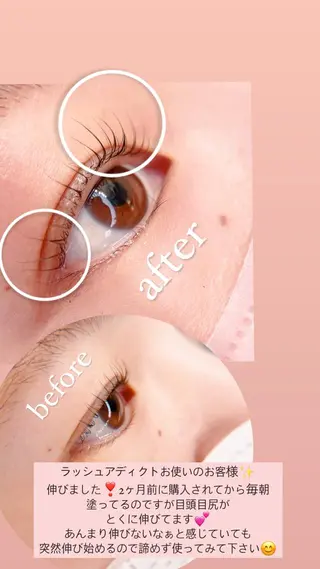 マツエク・マツパ Chante Lily所属・森崎 麗のマツエク・マツパデザイン