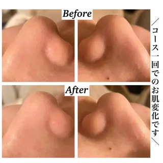 Bellesthe (ベルエステ)のエステ・リラクイメージ