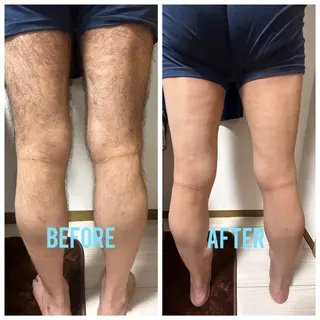 メンズ メンズ脱毛サロン shavys所属・shavys せいじのエステ・リラクイメージ