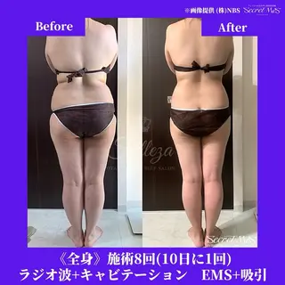 メンズ 有人型セルフサロン 脱毛/痩身/美顔のその他イメージ