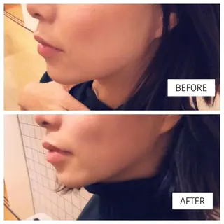 Relama 美容鍼×マッサージ所属・Relama/リラマ 美容鍼×マッサージのエステ・リラクイメージ