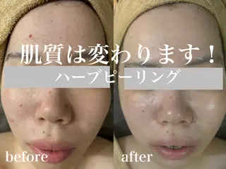 WHITE AQUA 北千住店のエステ・リラクイメージ