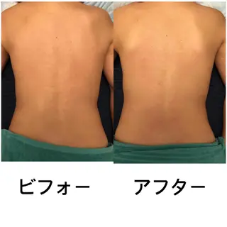 おうちサロン B-ROOMのエステ・リラクイメージ