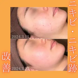 🫧ビュースタ 伊藤🫧のエステ・リラクイメージ